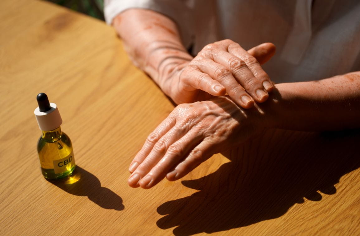 Homeopathy for Rheumatoid Arthritis: Naturally Reduce Pain