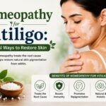 Homeopathy for Vitiligo: Natural Ways to Restore Skin